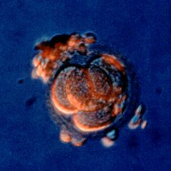 This image of a four-celled, human embryo, was captured with a light microscope.