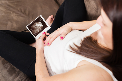 A pregnant woman looks at her ultrasound photo.