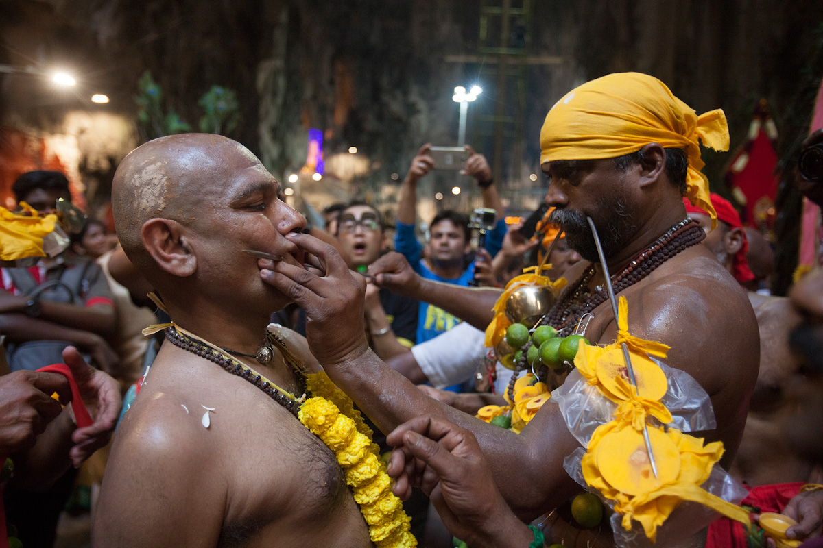 A Hindu devotee is having the skewer that pierced his cheeks removed after completing his Thaipusam pilgrimage in Kuala Lumpur, Malaysia on Jan 24, 2016. Religion News Service photo by Alexandra Radu