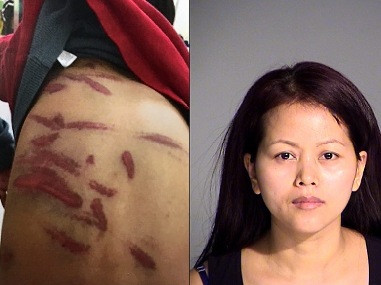 (LEFT) Some of the wounds suffered by the 7-year-old boy. Image is evidence filed in Marion (Ind.) Superior Court via The Indianapolis Star
(RIGHT) Kin Park Thaing is suspected of beating her son with a plastic coat hanger. Photo courtesy of Metropolitan Police Department in Indianapolis, via The Indianapolis Star