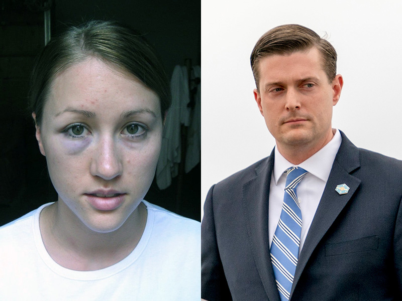 Bruises on Colbie Holderness, left, after an alleged 2005 assault incident by her then-husband, Rob Porter, right, seen in 2018.  (Left photo courtesy of Colbie Holderness; Right AP Photo/Andrew Harnik)