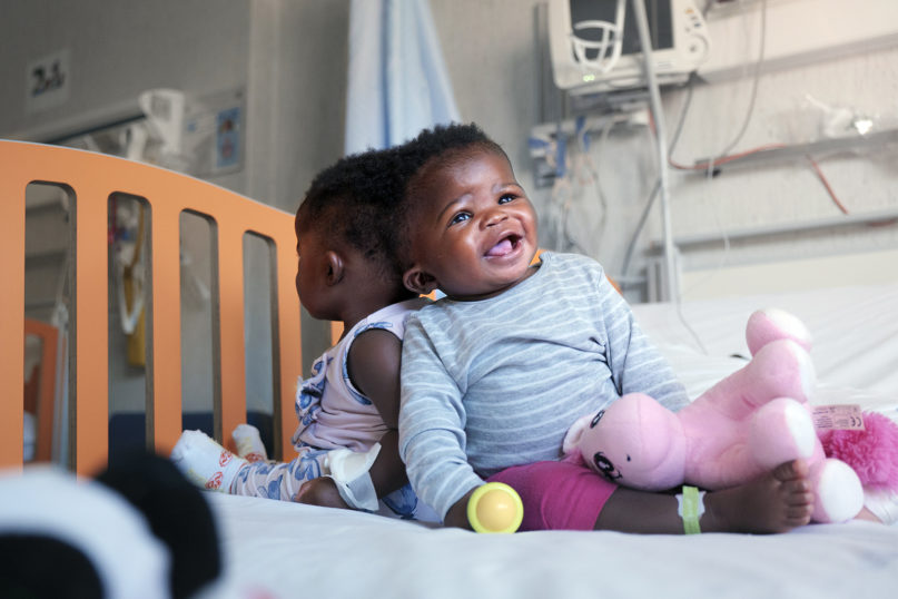 Conjoined twins Ervina and Prefina at Bambino Gesú in Rome in 2019. The twins were brought to Rome in 2018 from the Central African Republic. Photo courtesy of Ospedale Pediatrico Bambino Gesú