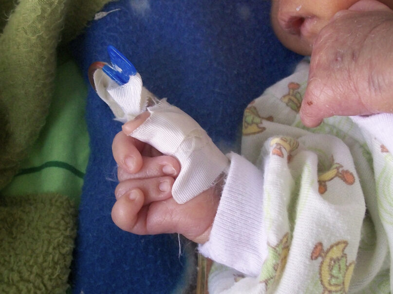 Recalling one of the most difficult decisions a family can make